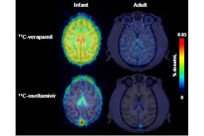子どもの脳はタミフルの影響を受けやすい…理研ら確認 画像