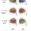 ナイフ使用中、および使用前後でのマス計算中の脳活動量比較（上段：マス計算中の脳活動量／ナイフ使用前、中段：ナイフ使用中の脳活動量、下段：マス計算中の脳活動量／ナイフ使用後）
