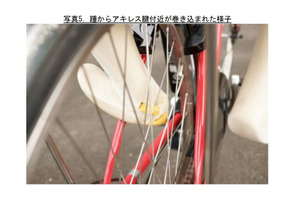 6歳以上は同乗危険、足が自転車の後輪に巻き込まれる「スポーク外傷」に注意 画像