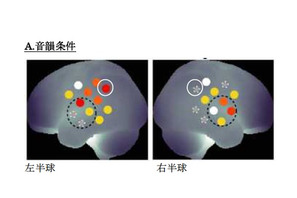 新生児も左右の脳を使い分け…慶大が発表 画像