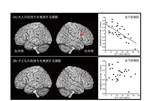 子育てストレスを早期発見、福井大研究グループが評価法開発 画像