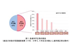 子供の歯並び、半数以上が歯列不正...口呼吸・姿勢が影響 画像