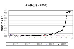 伝染性紅斑、埼玉県で9年ぶり警報発令…予防策は？ 画像