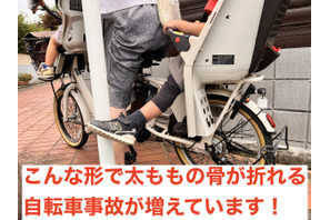 子供乗せ自転車、幼児の太もも骨折が多発…日本小児救急医学会 画像
