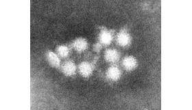 ノロウイルスの電子顕微鏡像　（c）国立感染症研究所