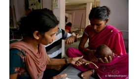 ビハール州で重度栄養失調の治療をうける子ども
