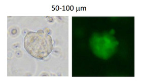 蛍光顕微鏡による酸処理後形成されるSTAP様細胞塊の緑色蛍光検出