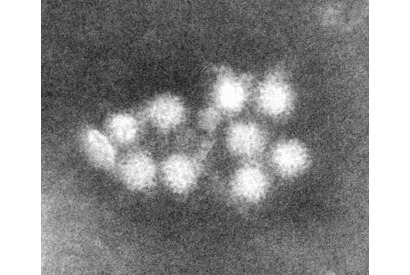 感染性胃腸炎、10都県で警報…受験生は特に注意 画像