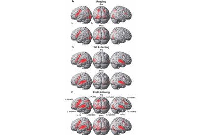 短期間の留学、脳機能に顕著な変化…東大調査 画像