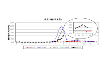 手足口病、流行警報発令中…埼玉県 画像