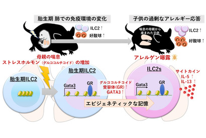 妊娠中の喘息・子供の喘息悪化のメカニズム解明…九州大 画像