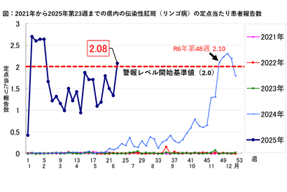 伝染性紅斑（リンゴ病）急増、妊婦は要注意…千葉県は警報レベルへ 画像