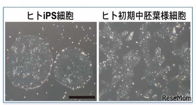 人のiPS 細胞と初期中胚葉様細胞の位相差顕微鏡写真
