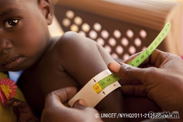 栄養センターで栄養状態の検査を受ける子ども（チャド）