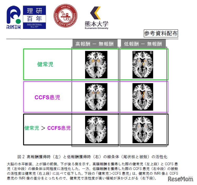 高報酬獲得時（左）と低報酬獲得時（右）の線条体の活性化