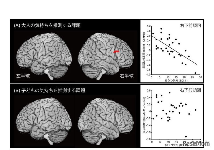 大人または子どもの気持ちを推測する課題時に選択的な脳活動と抑うつ気分の間で関連を示した脳領域