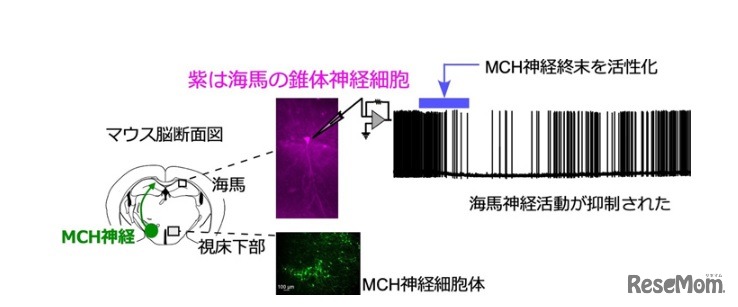 視床下部のMCH神経と海馬における神経活動の抑制