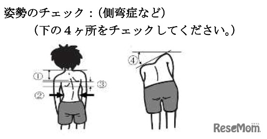 姿勢のチェック