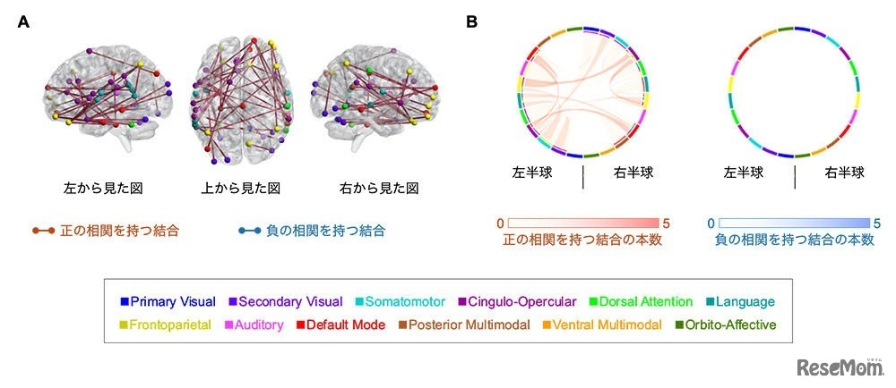 児童期の運動経験を有する人特有に認められるGo／No-Go課題の誤答率と関わる機能的領域間結合