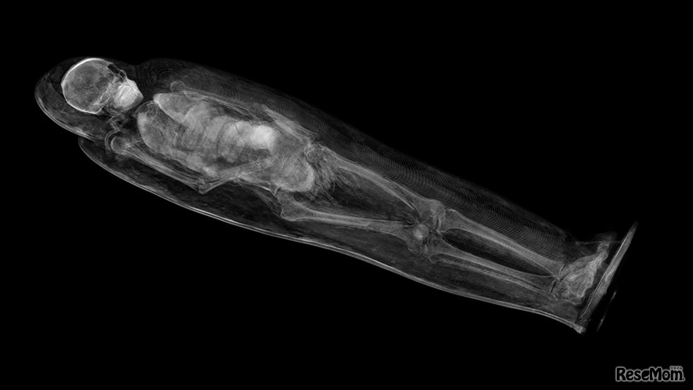 古代エジプトミイラの謎「デジタル解剖室へようこそ」再上演