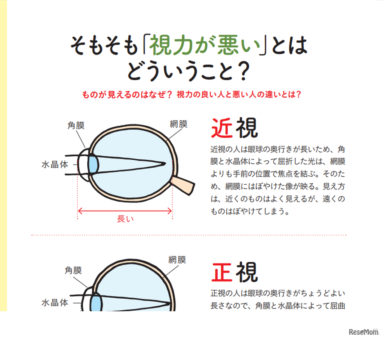 そもそも「視力が悪い」とはどういう事か