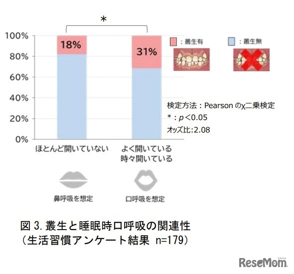 叢生と睡眠時口呼吸の関連性