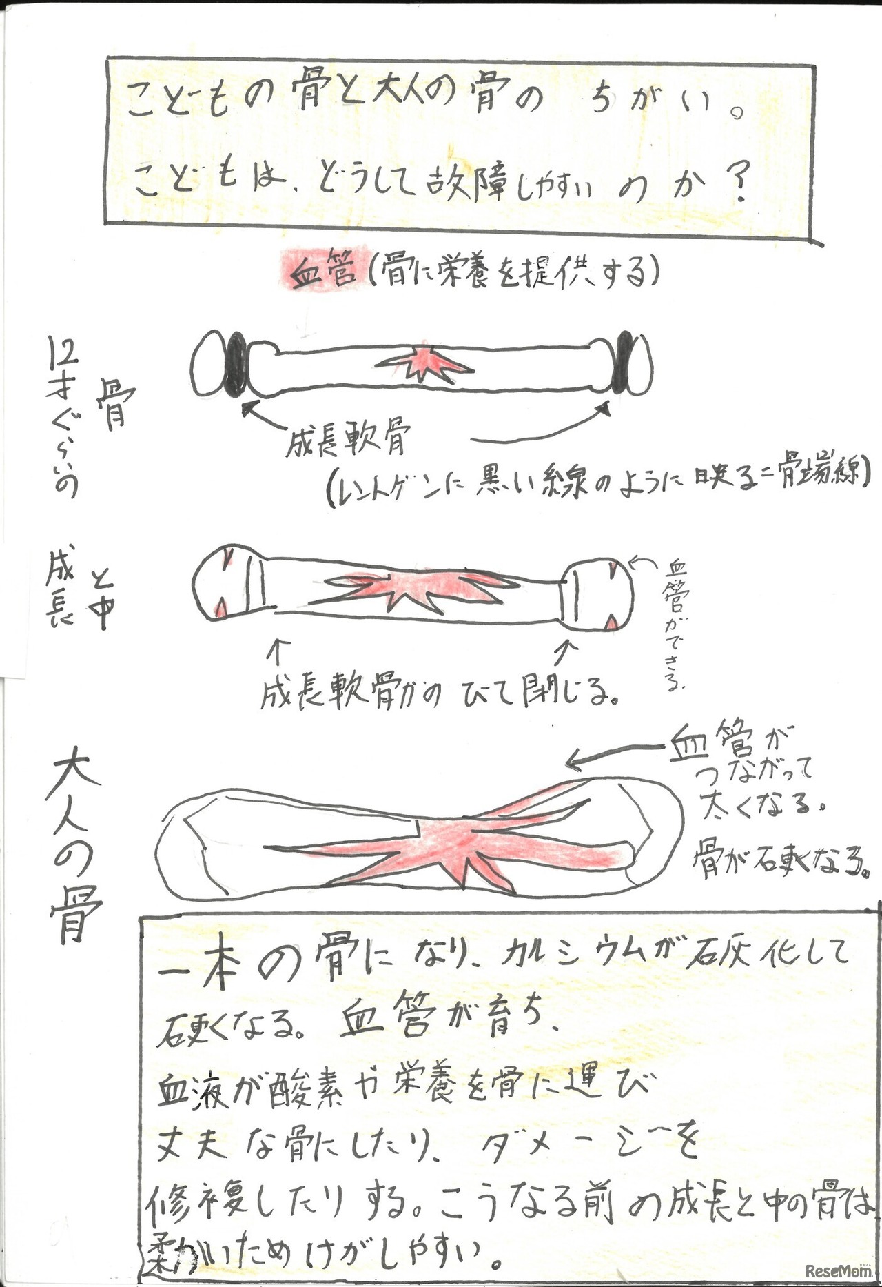 最優秀賞「小学生野球選手の野球肘について」