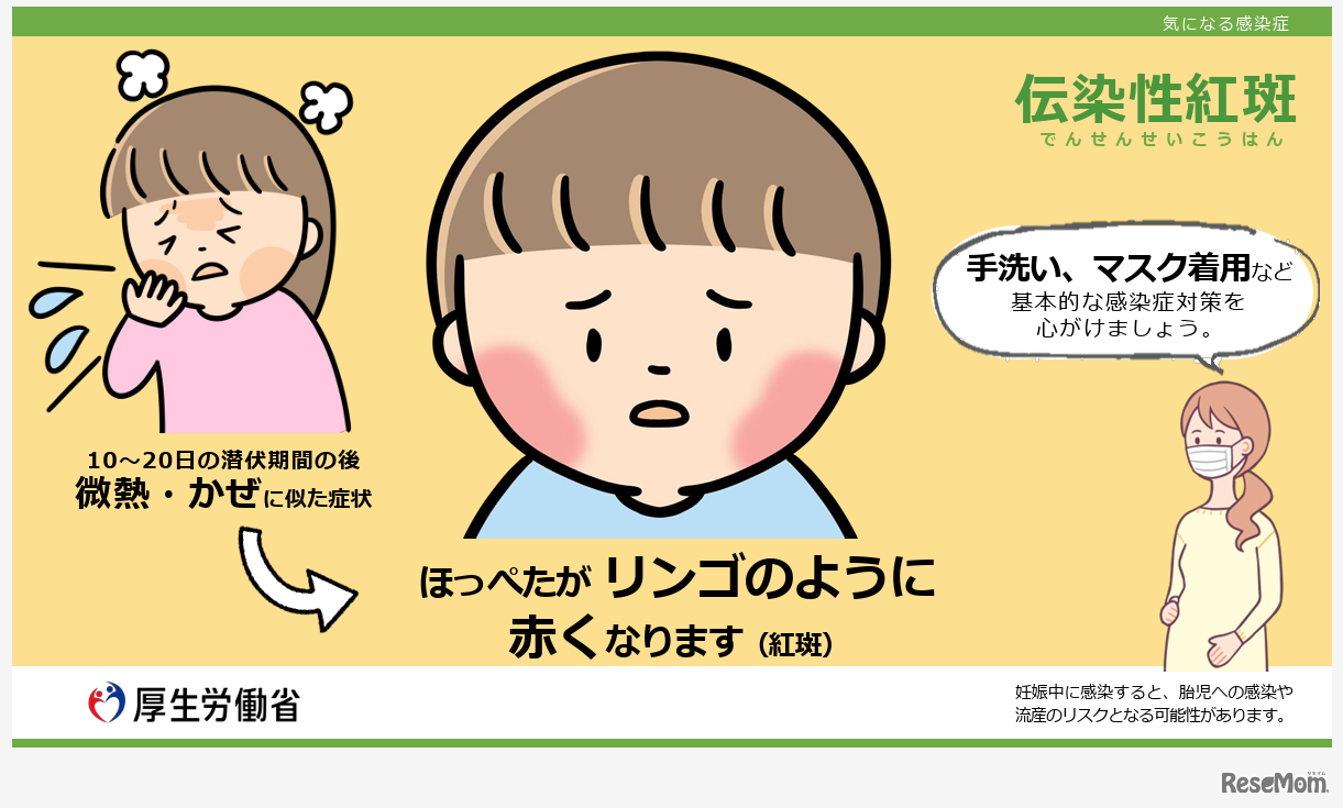 厚生労働省、伝染性紅斑（リンゴ病）に注意喚起