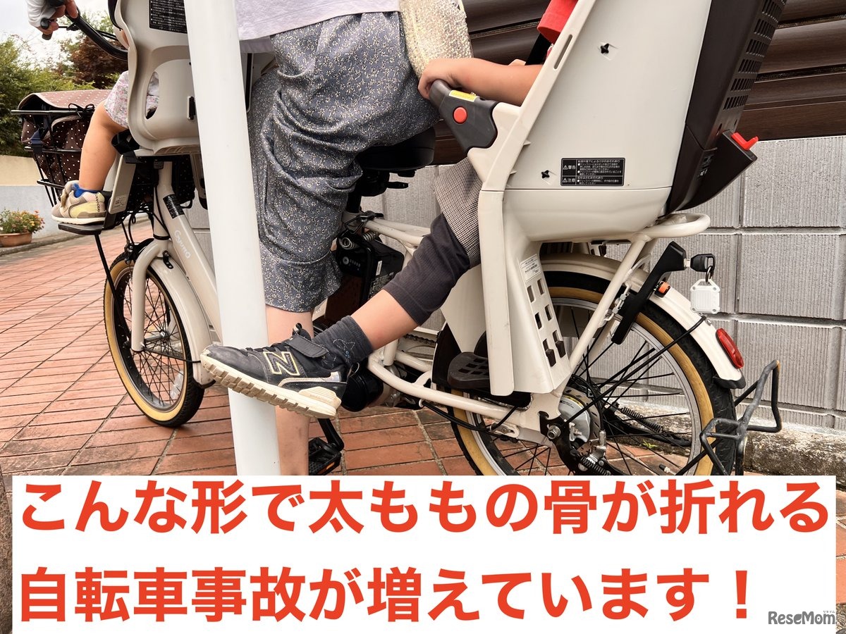 こんな形で太ももの骨が折れる事故が増えています