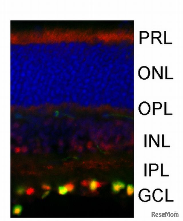 網膜内でのWNT7Bの発現