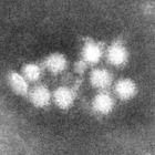 感染性胃腸炎、10都県で警報…受験生は特に注意 画像