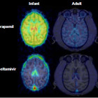 子どもの脳はタミフルの影響を受けやすい…理研ら確認 画像
