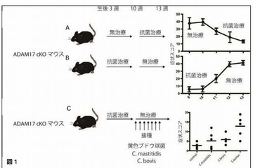 慶應医学部、アトピー性皮膚炎の原因を解明 画像
