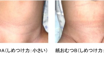 紙おむつのしめつけが乳幼児の睡眠に影響…花王の研究成果 画像