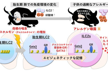 妊娠中の喘息・子供の喘息悪化のメカニズム解明…九州大 画像
