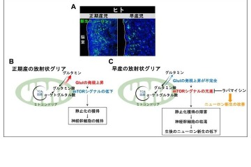 早産児の神経発達予後改善に新知見、名古屋市立大ら研究 画像