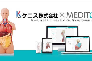 MEDITOR、医学教育に革新…3DCGモデル200点以上 画像