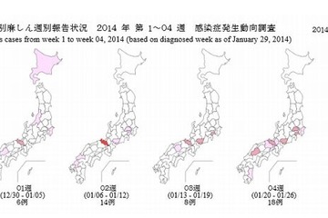 はしかが流行、前年同期比から倍増…京大も患者発生で注意喚起 画像