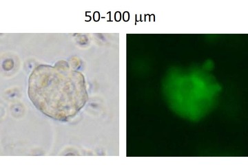 STAP現象確認できず、小保方氏退職 画像