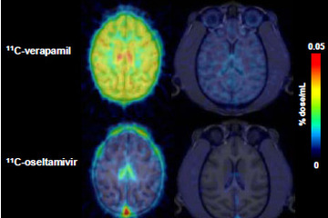 子どもの脳はタミフルの影響を受けやすい…理研ら確認 画像