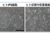 iPS細胞から人の生殖細胞、効率的な誘導に成功…京大研究グループ 画像