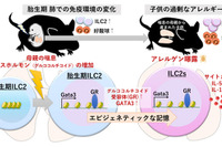 妊娠中の喘息・子供の喘息悪化のメカニズム解明…九州大