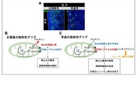 早産児の神経発達予後改善に新知見、名古屋市立大ら研究