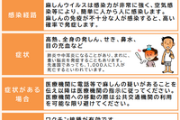 麻しん感染拡大防止へ、神奈川県が接触者向け無料ワクチン接種