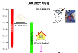 東京医科大、脳の記憶中枢形成の謎を解明…発達障害など原因究明に期待 画像