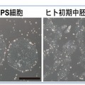 人のiPS 細胞と初期中胚葉様細胞の位相差顕微鏡写真