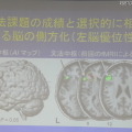 酒井氏の研究結果。言語を習得が得意な人は、文法中枢が非対称で、体積も大きく優位になることを突きとめた