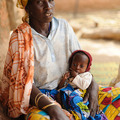 ニジェールに住む生後3 か月のサヒナトウ・マハマドウちゃん。ニジェールでは約300 万人の子どもたちが飢餓に直面しており、サヒナトウちゃんも重度の栄養不足に陥っている