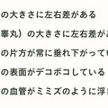 自分で気づける「セルフチェック」