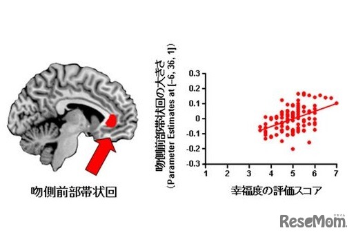 幸福度と吻側前部帯状回の大きさとの関連